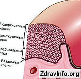 Kuzey Savaşının başlangıcı, aşamaları ve nedenleri. Kuzey Savaşının Sonuçları Kuzey Savaşının başlangıcı, aşamaları ve nedenleri. Kuzey Savaşının Sonuçları