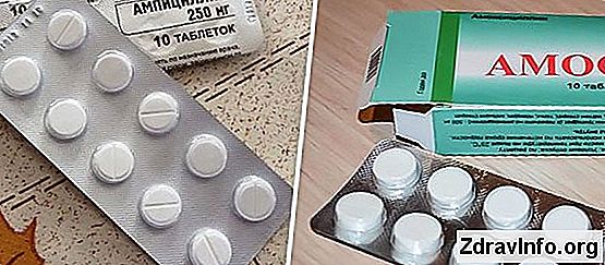 Çocuklar Ve Yetişkinler, Önemli Önerilerde Otitis Media Için Antibiyotikler Otit popüler antibiyotik tarayın
