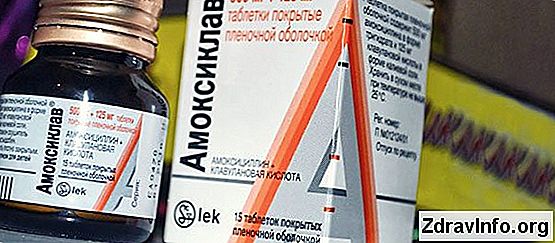 Amoxiclav Anjin Ile, Yetişkin Ve Anjin Tedavisinde Çocuklarda Pürülan angina tedavisinde amoksiklav nasıl kullanılır? Dozajı seçimi