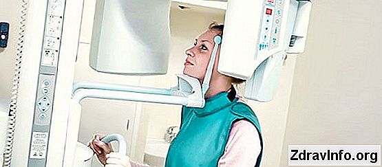 Röntgende Tipik Belirtileri, Anlamak Resimdeki? Röntgende sinüzit nedir: sinüste sinüslerin
