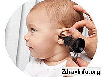 Bir Çocukta Orta Kulak Iltihabı (Kulak Enfeksiyonu) Tedavisi Için Ve Nasıl Bir Çocukta Akut Otitis Media Durumunda Ağrıyı Hafifletmek Için Güvenlidir Ne Nasıl bir çocuk orta kulak iltihabının tedavisi için