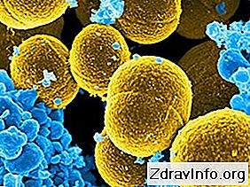 Staphylococcus aureus: co to jest i jak niebezpieczne jest