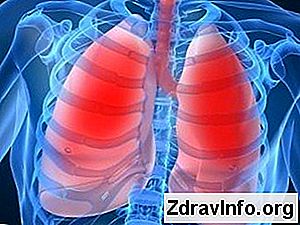 Як лікувати алергічний кашель: кашель