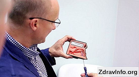 Zapalenie Zatok Home Treatment - Przepisy Kulinarne 艢rodki Folk Zatok leczenie 艣rodk贸w ludowej - 5 najbardziej skuteczne metody