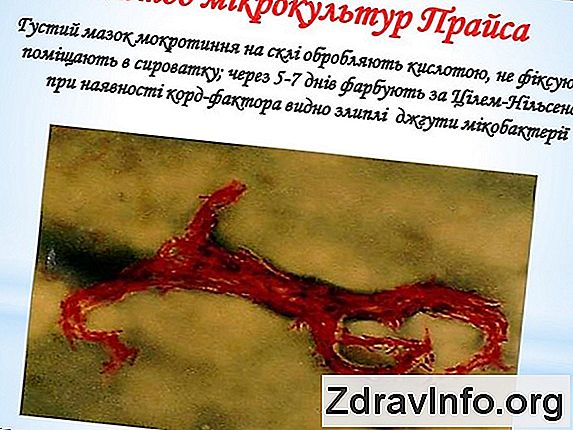 Чи Можна Робити Діаскінтест При Нежиті? Діаскінтест при застуді і нежиті