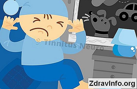 Пульсирующий Шум У Вусі: Причини І Лікування Пульсирующий шум і стукіт у вухах: причини і лікування
