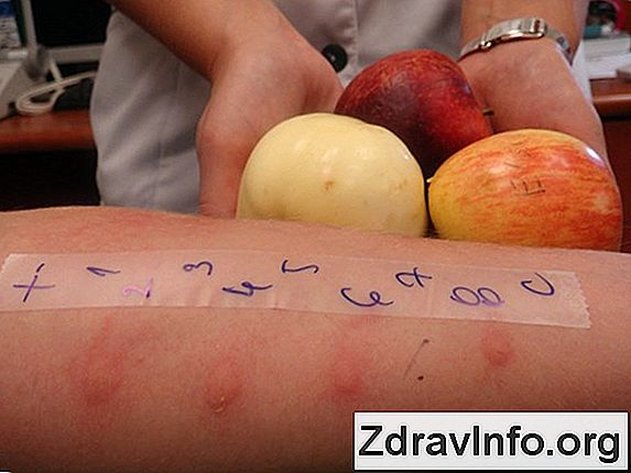 Katar Z膮bkowanie U Dzieci Nie偶yt nosa u dzieci z膮bkowanie - porady dla rodzic贸w