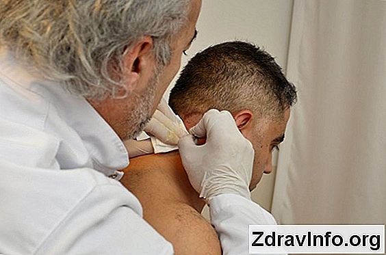 Arka Rinit Semptom Ve Çocuk Ve Yetişkin Rinit ve ortak bir rinit arasındaki fark nedir ve nasıl tedavi edilir?