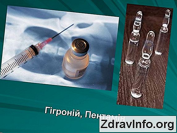 З Чим Робити Інгаляції При Нежиті? Які інгаляції корисні при нежиті, а які ні?