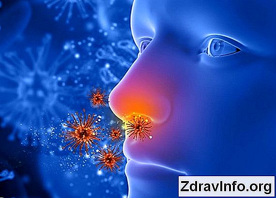 Przednie: Objawy I Leczenie R贸偶nych Metod Doros艂ych I Dzieci, Rzeczywistych G艂贸wne objawy zapalenia zatok