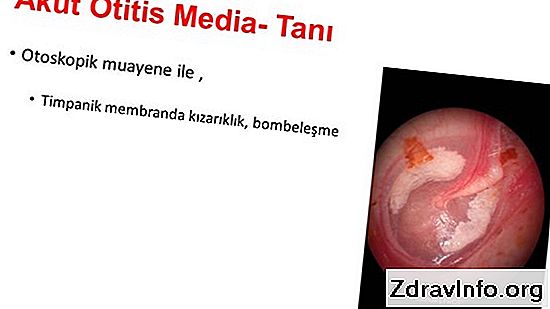 2019-2019 Yaz Trendleri: Püsküllü Elbise Modelleri ve Kombinleri 2019-2019 Yaz Trendleri: Püsküllü Elbise Modelleri ve Kombinleri