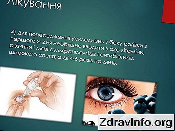 Хронічний Синусит: Симптоми У Дорослих, Способи Лікування Хронічного Синуситу Народними Засобами І Ліками Хронічний синусит: визначення та причини появи
