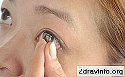 Краплі для очей Диклофенак - інструкція із застосування. Універсальний протизапальний розчин: препарат