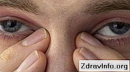 Краплі для очей Диклофенак - інструкція із застосування. Універсальний протизапальний розчин: диклофенак