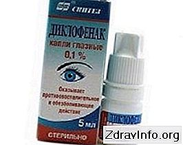 Краплі для очей Диклофенак - інструкція із застосування. Універсальний протизапальний розчин: краплі