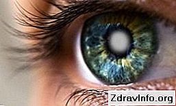 Які є причини чому двоїться в очах? Чи потрібно лікувати такий дефект?: око