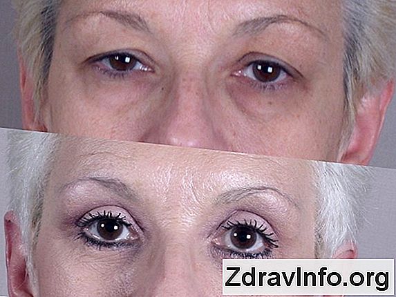 Çilekli Magnolia Videosu Çilekli Magnolia Videosu