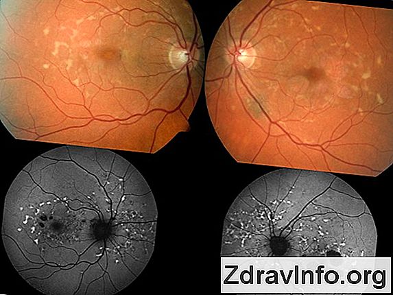Tığ İşi Delikli Yelpaze Örgü Modeli Yapılışı Türkçe Videolu Tığ İşi Delikli Yelpaze Örgü Modeli Yapılışı Türkçe Videolu