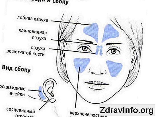 С чем граничит верхняя стенка клиновидной пазухи