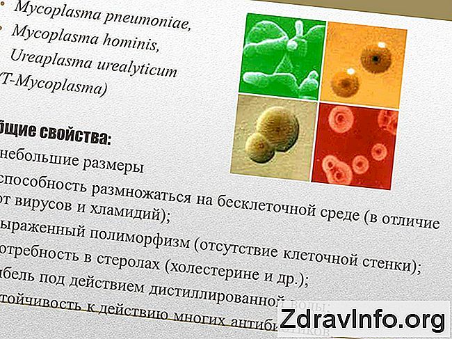 Схема лечения микоплазмы хоминис у женщин