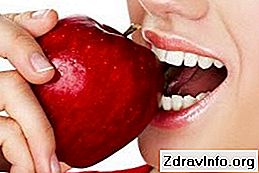 Лечение на левкоплакията на устната кухина 👃 Портал На Синусите И Др ...