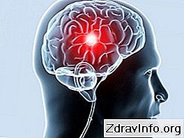 Kötü kan dolaşımı: nedenleri, belirtileri, sonuçları. Serebral dolaşım bozuklukları: semptomlar ve tedavi Kötü kan dolaşımı: nedenleri, belirtileri, sonuçları. Serebral dolaşım bozuklukları: semptomlar ve tedavi