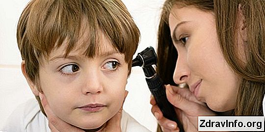 Pulsirajuća buka u uhu, koja se podudara s premlaćivanjem, bez boli