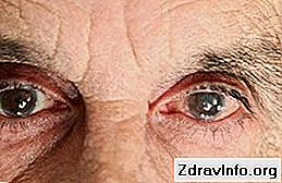 Krople do oczu Oftan Katachrom - wskazania i instrukcje użytkowania ...