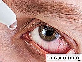 Krople do oczu Chlorowodorek fenylefryny - instrukcja. Dobry środek zwężający naczynia krwionośne i mydriatic: środek