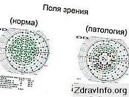 Поля зрения в норме схема