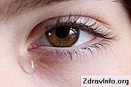 Gözlerde Rez - nedenleri Gözlerde Rez - nedenleri