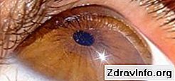 Лікування відшарування сітківки ока: можливі методи і прогнози: вартість