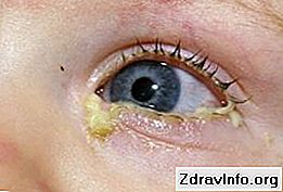 Dlaczego oczy noworodka wydają się słabe? Co powinienem zrobić w takich przypadkach? Niż w leczeniu choroby?: wydają