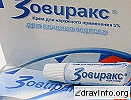 Мазь Зовиракс - інструкція та поради щодо застосування. Для лікування захворювань, викликаних вірусом герпесу: лікування